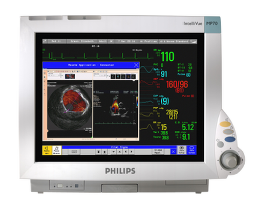 Philips IntelliVue MP70 Bedside Monitor